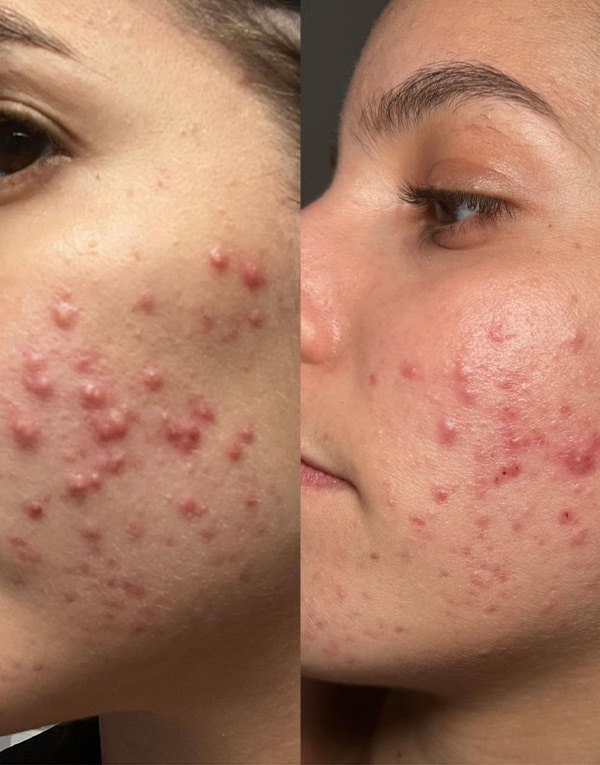 before-and-after-3-cell-story