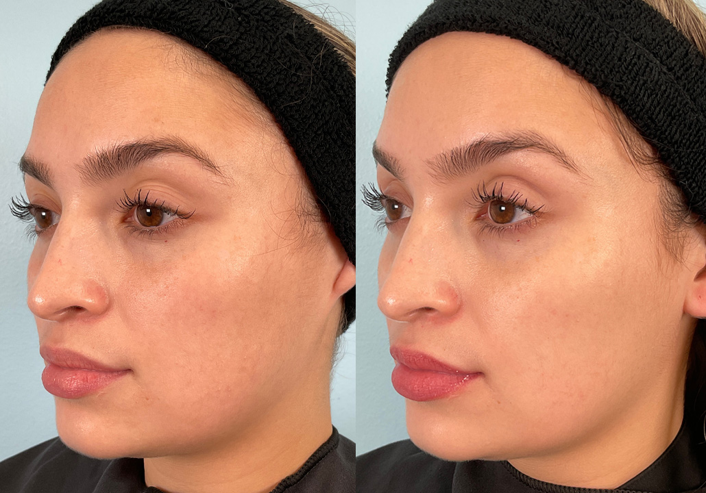 OX STUDY - Subject 001.a