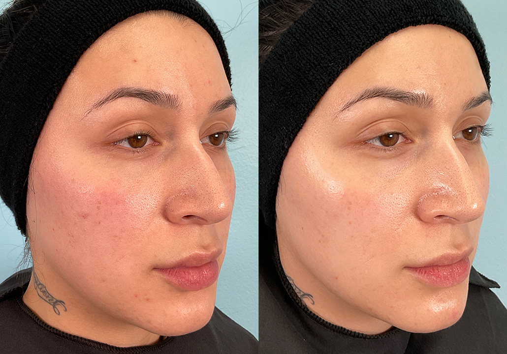 OX STUDY - Subject 028