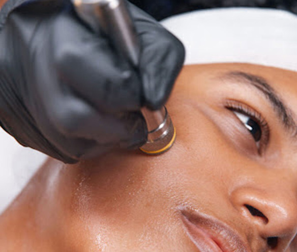 Health canada approved hydrodermabrasion machine